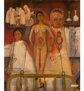 Frida And The Cesarean Operation