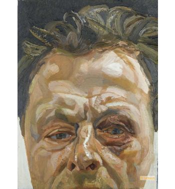 Self Portrait with a Black Eye